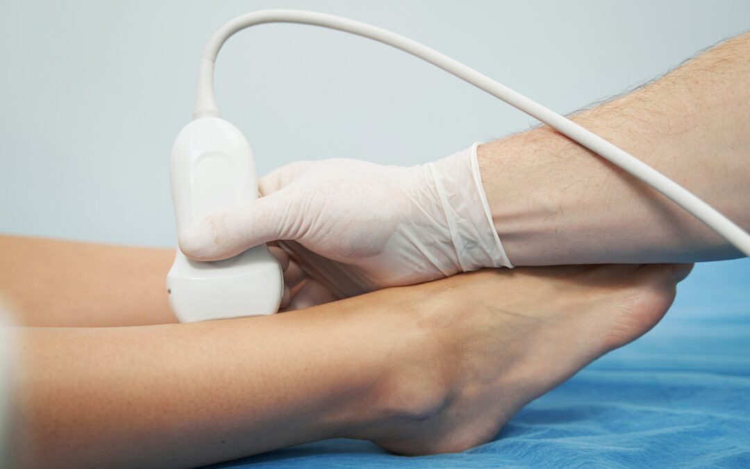 What is Treatment of DVT?