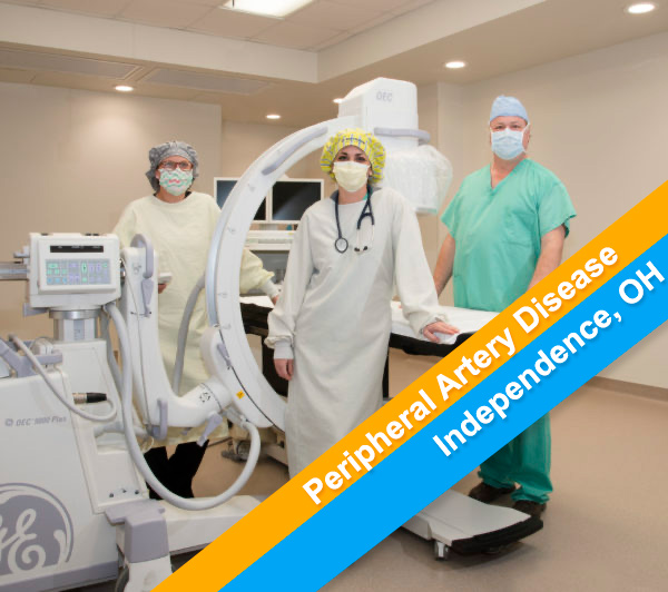 Peripheral Artery Disease Treatment Near You in Independence, Ohio